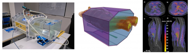 obr_radiofrekvencni_a_mikrovlnna_hypertermie.png
